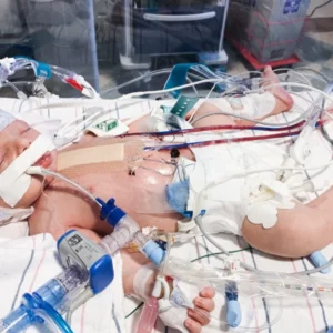 Donate to Help Baby Rhodes Open Heart Surgery 