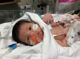 Donate to Help Baby Rhodes Open Heart Surgery
